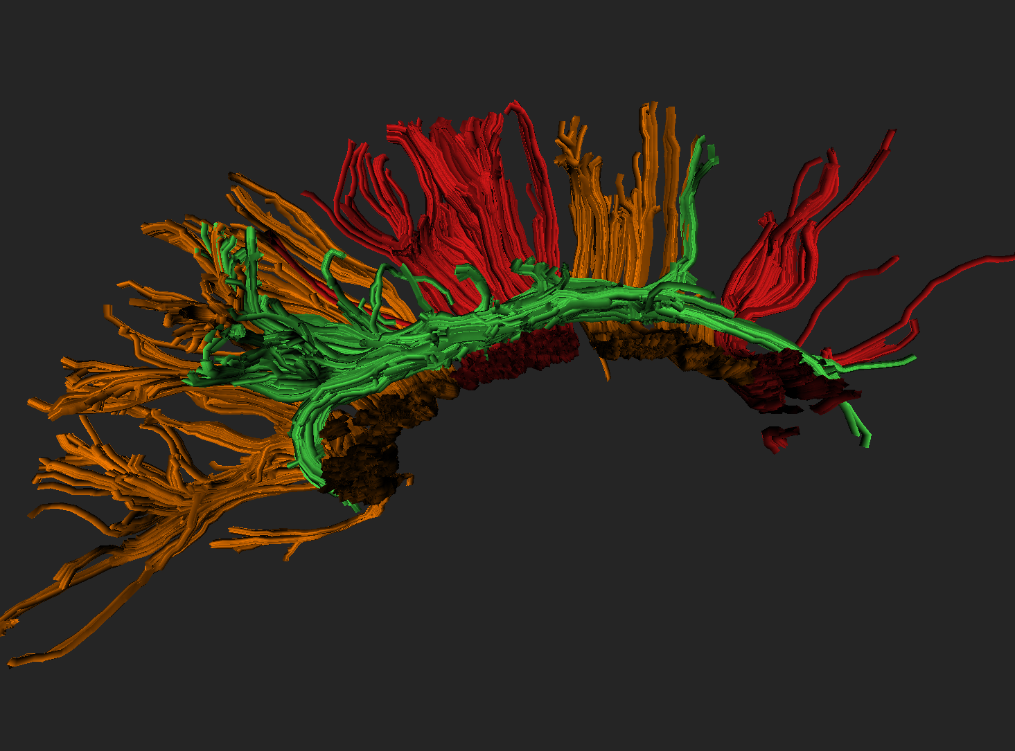 Tractograpy reconstruction from DTI